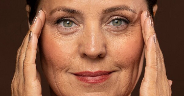 Ránctalanítás: lézer vagy botox?