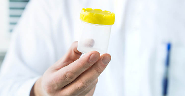 Mindent a spermadonációról