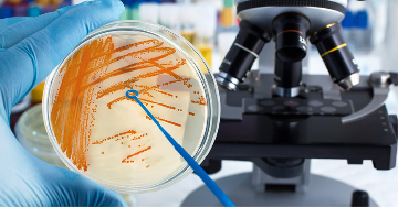 Streptococcus pyogenes, a húsevő baktérium