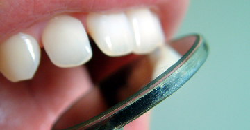 Milyen elváltozásokat okozhat a HPV-fertőzés a szájüregben?