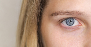 A farkasvakság egyik fő oka: a retinitis pigmentosa