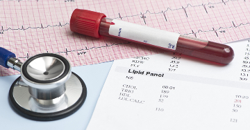 A szív állapotát jelző laborparaméterek