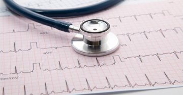 Szívritmuszavarok (arrhythmia)