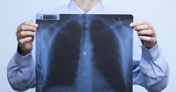 Mire figyeljünk inhalálás során? Mit kell tudni az inhalációs terápiákról?