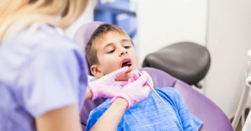 A túlzott fluorbevitel veszélye: a dentális fluorózis