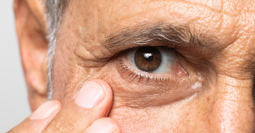 Az uveitis okai, tünetei, kezelése