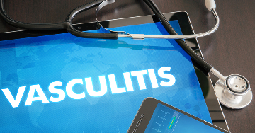 Az érgyulladás (vasculitis) tünetei és kezelése