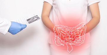 Megacolon (vastagbéltágulat)