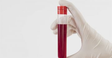 Különböző daganattípusok kimutatására is alkalmas az új típusú vérteszt