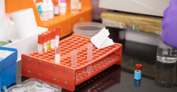 Véralvadási zavar a meddőség, vetélések hátterében