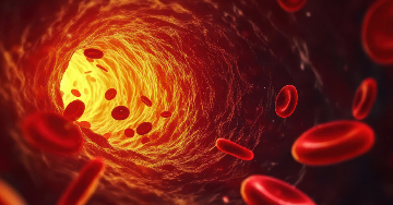 Mi a mélyvénás trombózis és miért veszélyes?