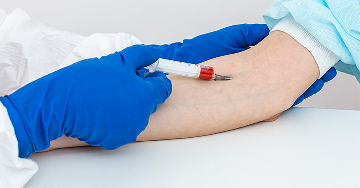 MPV - Miről ad információt ez a laboratóriumi paraméter?
