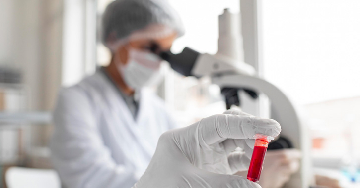 MCHC - Miről ad információt ez a laboratóriumi paraméter?
