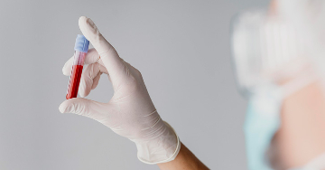 Kalcium a vérben mint laboratóriumi paraméter