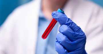 Az anaemia perniciosa (vészes vérszegénység)