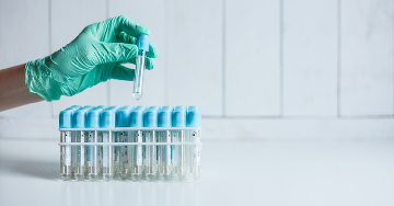 Az APC-rezisztencia (aktivált protein C rezisztencia)