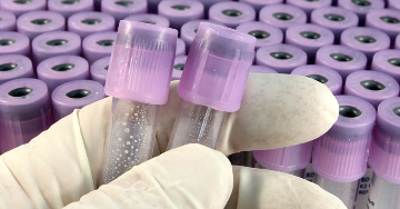 Antitrombin III (ATIII)