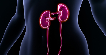 A hemofiltráció (HF)