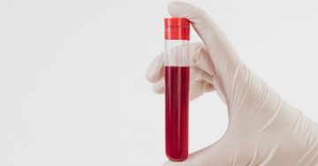 Laboreredmények: a D-dimer teszt