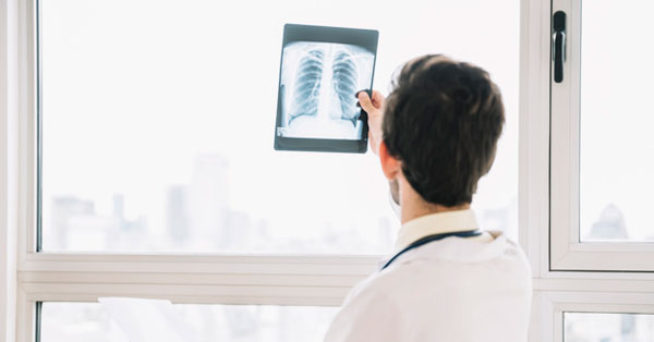 körtehártya a tüdőben röntgenfelvételen
