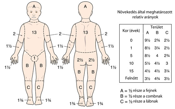 égési sérülés százalék