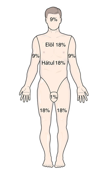 égési sérülés százalék