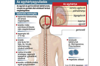 Kullancs is terjesztheti az agyhártyagyulladást