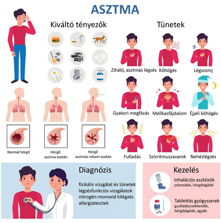 Asztma tünet, ok, vizsgálat, kezelés infografika