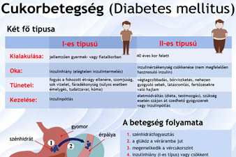 A cukorbetegség - Infografika