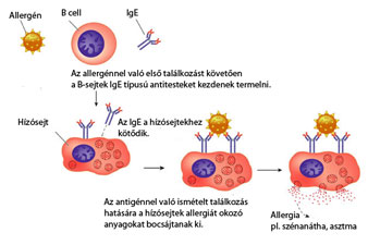 Az anafilaxiás roham azonnali ellátást igényel