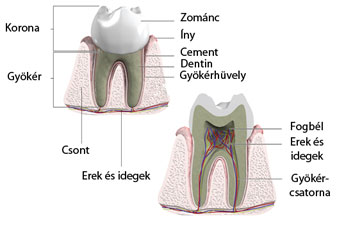 Az ínyvisszahúzódás, más néven ínyrecesszió okai, tünetei és kezelése - Dentpoint