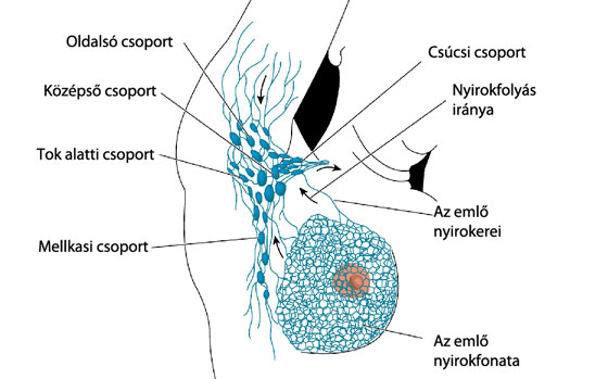 fájdalmas lehet-e a nyirokcsomók