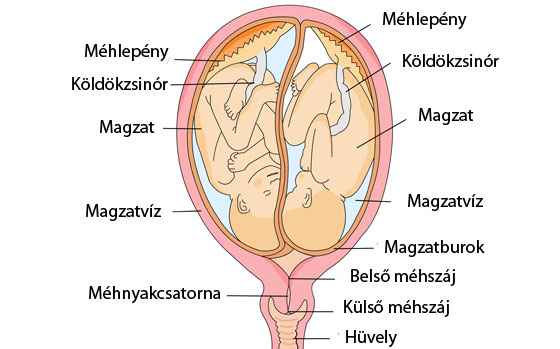 Ikerterhesség orvosi ábra