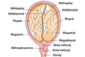 Az ikerterhességre való adottság öröklődik