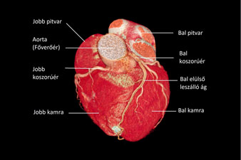 Képalkotás három dimenzióban is: a CT