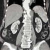 CT,Computertomograph