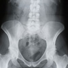 Medence röntgenfelvétele