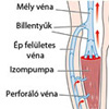 Mélyvénás trombózis és visszértágulat