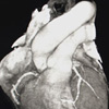 A szív - kardio CT képe