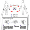 Trichomoniasis