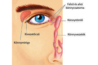 Csípő könnyező szem | az alábbiakban azt vesszük sorra, mi minden okozhatja esetleges