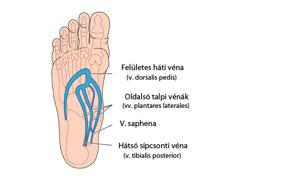 háti véna visszér