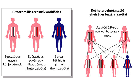 Örökölhető-e a cukorbetegség?