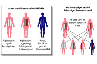 Magas vérnyomás genetikailag