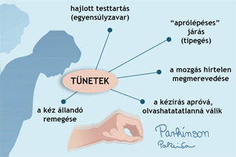 A Parkinson-kór előfordulása, okai, tünetei és fefolyása