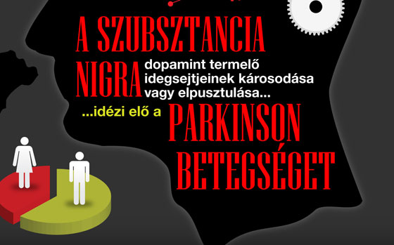 Parkinson-kór infografika