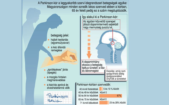 Látászavarok Parkinson-kórban