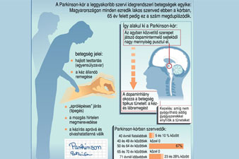 epilepszia kezelésére diabetes cukorbetegség kezelésére felnőtteknél és tünetei