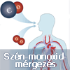 Szén-monoxid-mérgezés