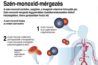 Szén-monoxid-mérgezés